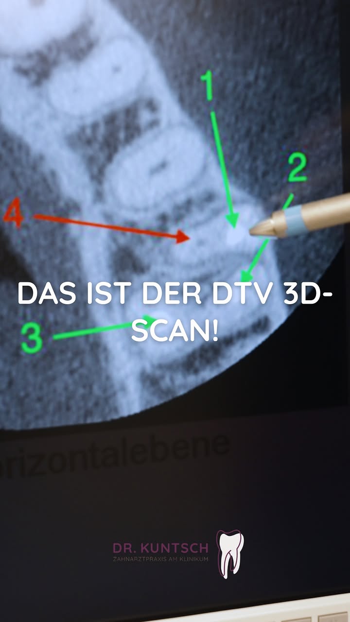 Hast du schon einmal vom DVT gehört?🤔 
#zahnarzt #zahnarztkempten #praxis #zahngesundheit #kempten #zahnmedizin