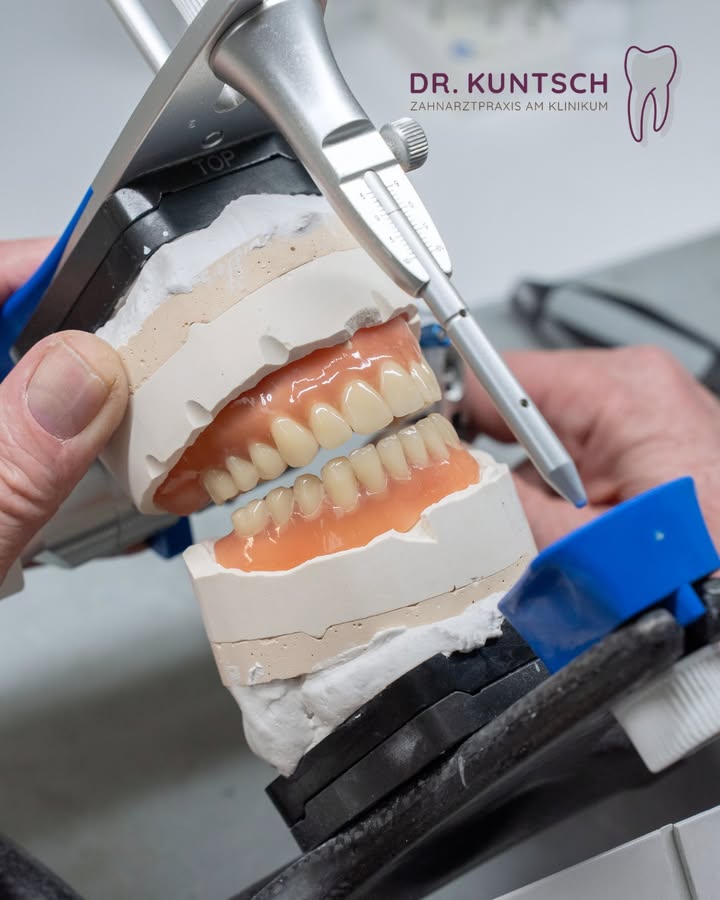 Für optimale Ergebnisse kommt es auf eine exakte Planung an! 🦷 
#zahnarzt #zahnarztkempten #praxis #zahngesundheit #kemp…
